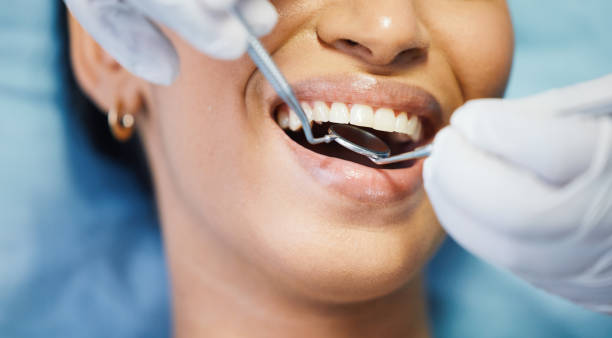 Best Emergency Dentist for Knocked-Out Tooth in Schoolcraft, MI
