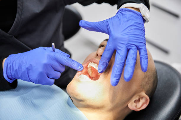 Best Emergency Dental Extractions in Schoolcraft, MI